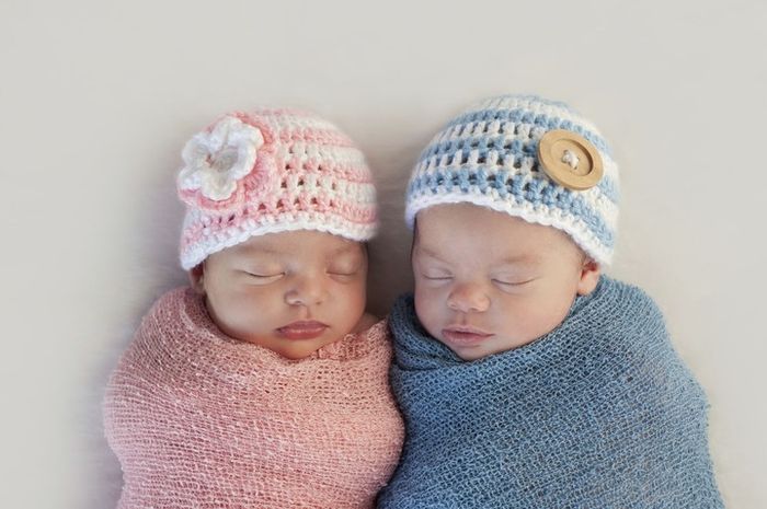Bayi Kembar Saat Lahir ini Sangat Unik