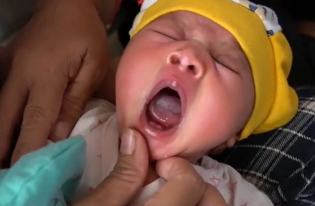 Tak Lazim Bayi Baru Lahir Tumbuh Gigi di Busel Bikin Heboh